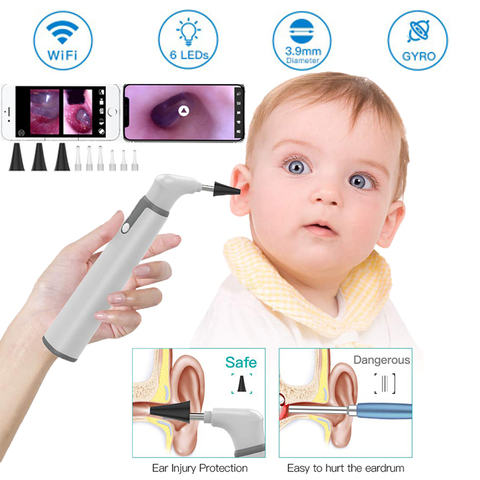 Otoscopio médico con cámara endoscópica Digital, limpiador de cera de los oídos, con pantalla para orejas, nariz y Dental, 3,9mm, Wifi ► Foto 1/6