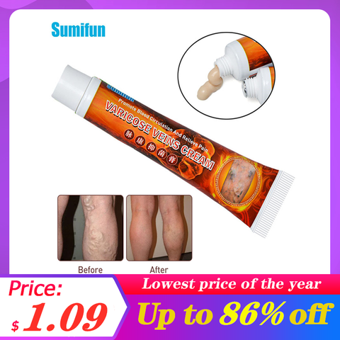 Sumifun-Crema para tratamiento de venas varicosas, angitis, remedio, pomada para aliviar el dolor de las venas, flebitis, piernas, crema venas varicosas ► Foto 1/6