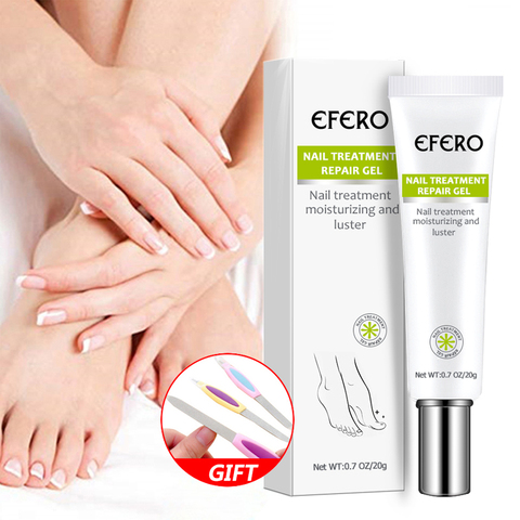 Suero para tratamiento de uñas por hongos, Gel para eliminación de hongos en los pies, antiinfección, onicomicosis, crema para reparación de uñas, cuidado de los pies ► Foto 1/6