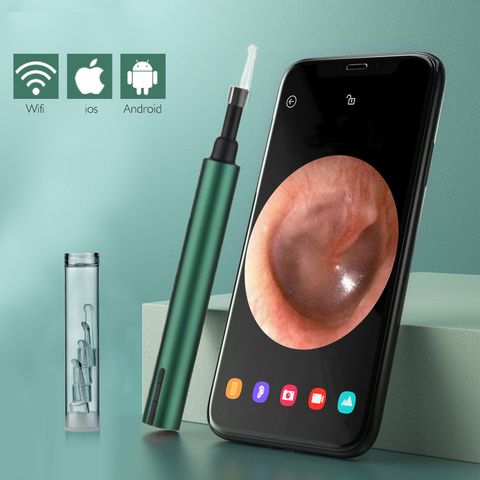 Otoscopio inalámbrico con WiFi para limpieza de dientes, boroscopio, cera de los oídos, 3,0/3,0 MP ► Foto 1/6