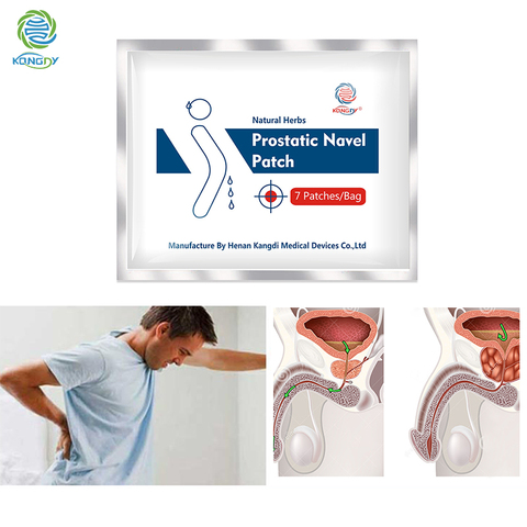 KONGDY-Parche prostático para el ombligo, parche Natural para aliviar la emergencia urinaria, tratamiento prostático masculino, 14 Uds. ► Foto 1/6