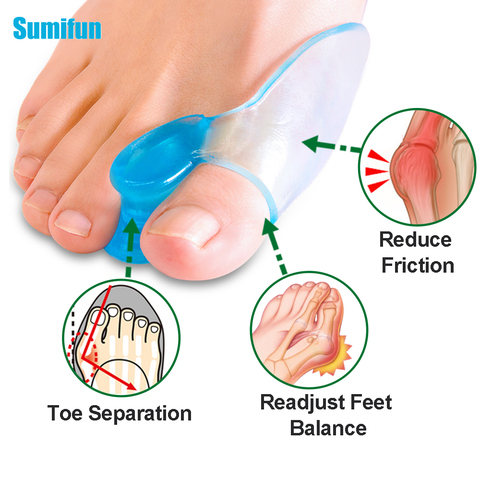 Uds azul Gel de silicona del dedo del pie separador pulgar separador de superposición de Corrector de Hallux Valgus pulgar juanete espaciadores de cuidado de los pies ► Foto 1/6