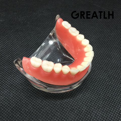 Dental sobredentadura Interior Mandibular inferior dientes modelo Mandibular con implante de restauración diente Dental estudio pedagógico ► Foto 1/5