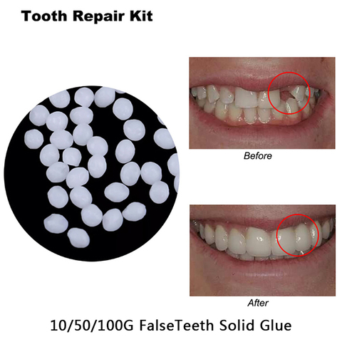 Pegamento sólido de resina para dentadura, adhesivo para dentadura, dentistas, juego de reparación temporal de dientes, 10g ► Foto 1/6