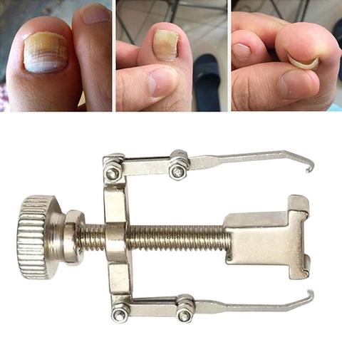 Utensilio de reparación de dedos de los pies encarnados, dispositivo de corrección de pedicura, cuidado de las uñas del pie, herramienta de alisado, corrector ortopédico, fijador de alambre ► Foto 1/6