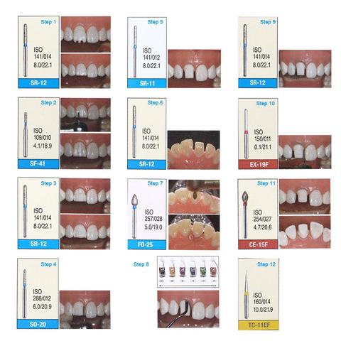 1 cajas de brocas de diamante Dental brocas de fresa Dental para herramientas de alta velocidad sin mano de dentista mediano ► Foto 1/6