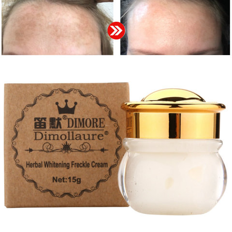 Dimollaure, fuerte eliminación de melasma, crema blanqueadora, manchas de pecas, quemado por Sol, pigmento, eliminación de cicatrices de melanina, crema facial Dimore ► Foto 1/6