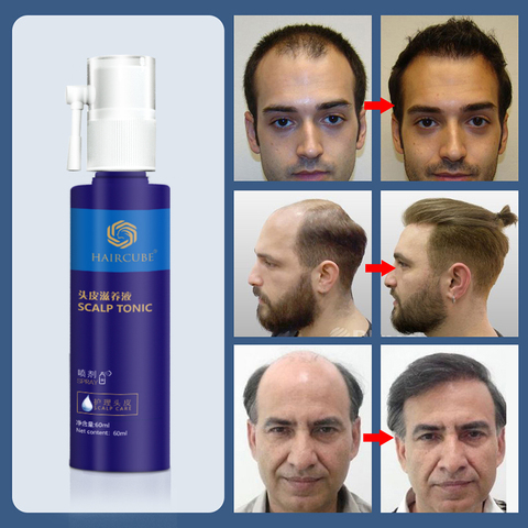 REAGAIN prevenir la pérdida de cabello productos para el crecimiento del cabello esencia crecer restauración ► Foto 1/6