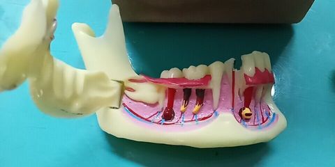 Modelo de tratamiento endodontico Dental, modelo para enseñar a los dientes la anatomía de las encías ► Foto 1/4