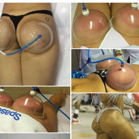 Bomba para aumento de mamas, dispositivo de terapia de succión al vacío para Realce de glúteos ► Foto 1/6