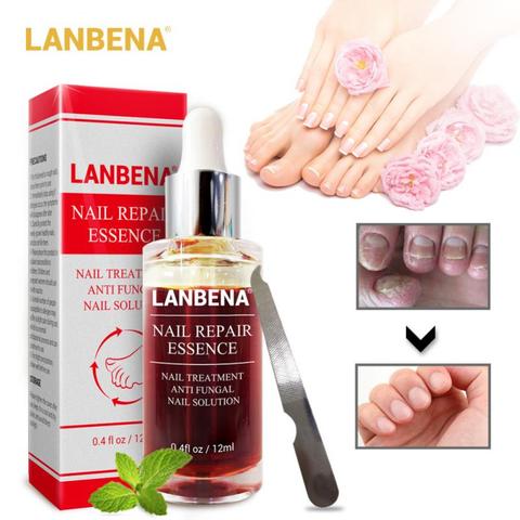 LANBENA-suero para reparación de uñas, Gel para eliminación de hongos en los pies, antiparoniquia, onicomicosis ► Foto 1/6