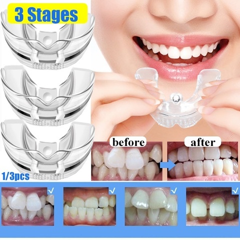 Aparatos de ortodoncia Dental de 3 etapas para adultos, Corrector de alineación, entrenador, herramienta de cuidado Dental ► Foto 1/6