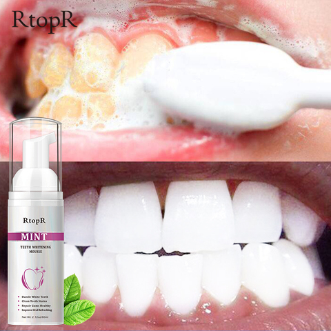 RtopR-manchas de limpieza de dientes, elimina el aliento, frescura, blanqueamiento de dientes, Mousse, higiene Oral, espuma Mousse, pasta de dientes portátil de viaje ► Foto 1/1