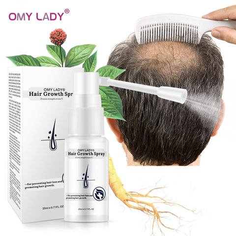 OMY LADY Anti pérdida de cabello Spray para el crecimiento del cabello líquido esencial para hombres mujeres reparación de la regeneración seca del cabello, productos para la pérdida de cabello ► Foto 1/6