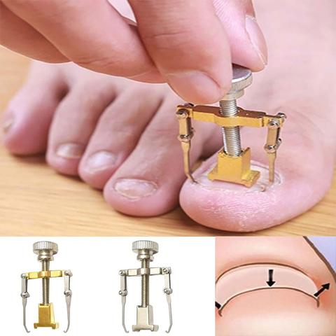 Ingrown-herramienta para el cuidado de las uñas del pie, dispositivo de corrección de dedos de los pies, para pedicura, fácil de usar ► Foto 1/6