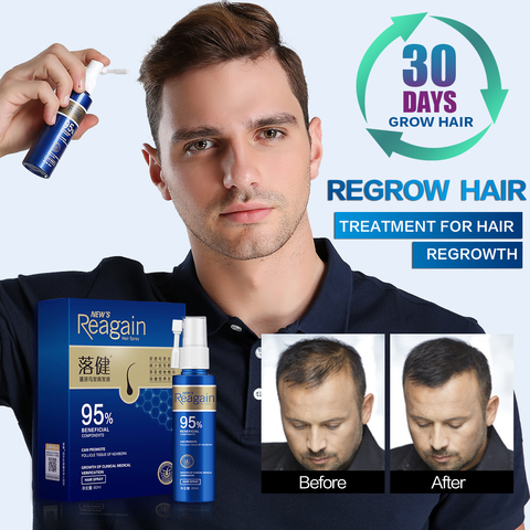 Spray para el crecimiento rápido del cabello para hombre, para cuerpo, pecho, cejas y barba, producto para la pérdida de cabello grueso, 60ml y 20ml ► Foto 1/6