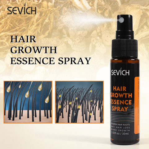 Sevich-Spray para el crecimiento rápido del cabello, líquido para evitar la caída del cabello, para reparación de cabello dañado, tratamiento antipérdida ► Foto 1/6