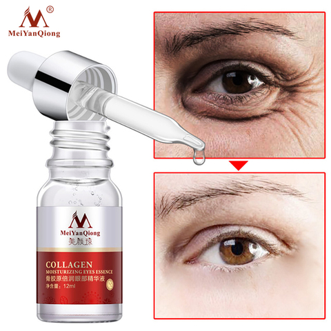 ¡Novedad! Cuidado de la piel profunda, Facial, antiedad, 12ml, Lifting Facial intensivo, esencia reafirmante, eliminador de arrugas, esencia para los ojos ► Foto 1/6