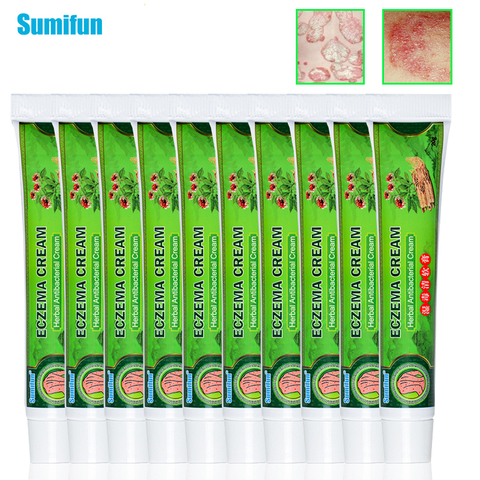 Sumifun 10 Uds caliente crema para la Psoriasis antibacteriano antiprurítico Dermatitis eccema ungüento chino hierbas medicinales de yeso de cuidado de la piel ► Foto 1/6