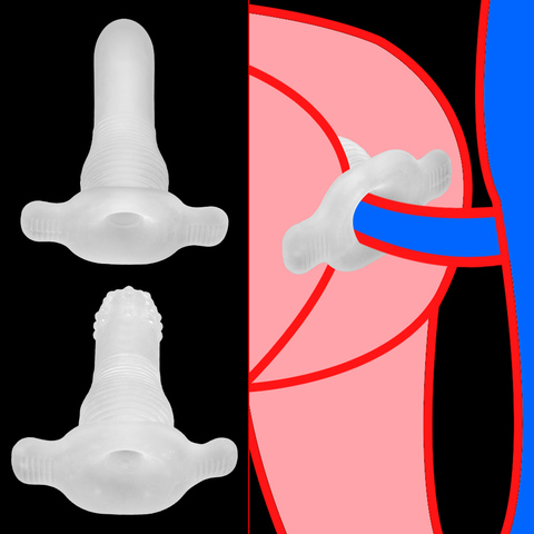 Consolador tapón de silicona para adultos juguetes de sexo Anal para mujeres y hombres, masajeador de próstata, dilatador expansible Anal, productos para adultos ► Foto 1/6