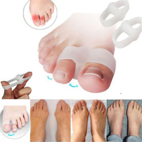 2 unids/par pie Gel para aliviar el dolor almohada Hallux Valgus Pro separadores de dedo alineación plantillas de silicona juanete ► Foto 1/6