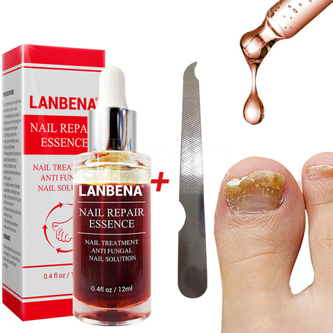 Uñas Lanbena reparan esencia antimicóticos para hongos de uñas tratamiento de remedios Antihongos Lambena en pierna antimicótica ► Foto 1/6