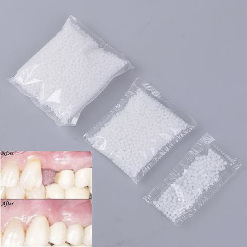 Juego de reparación de dientes temporales de cola sólida, 5g/10g/50g/100g, adhesivo para dentadura, dentista ► Foto 1/6
