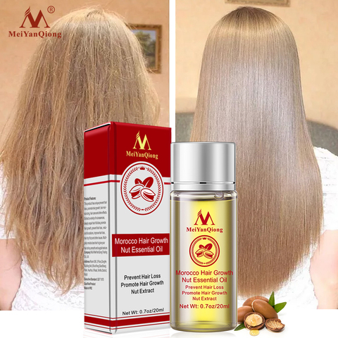 Esencia para el crecimiento del cabello, productos para la pérdida de cabello, tratamiento líquido de aceite esencial para prevenir la pérdida de cabello, productos para el cuidado del cabello 20ml ► Foto 1/6