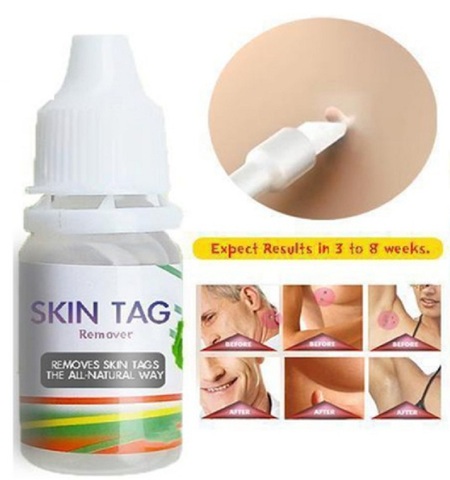 Eliminador de marcas en la piel, tratamiento de verrugas, papilomas, eliminación líquida contra Moles, pomada antiverrugas, remedio, 10ml ► Foto 1/6