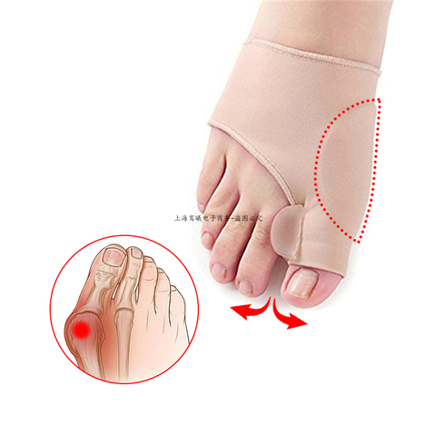 1 pares calcetines huesos ortopédicos juanete corrección de Corrector de Hallux Valgus aparato separadores de dedos de cuidado de los pies herramienta ► Foto 1/6