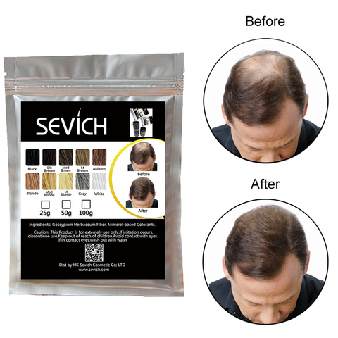 Sevich-producto corrector para la pérdida de cabello, producto extensor de pelo, polvo de fibra de queratina para el cuidado del cabello, 50g/100g ► Foto 1/6