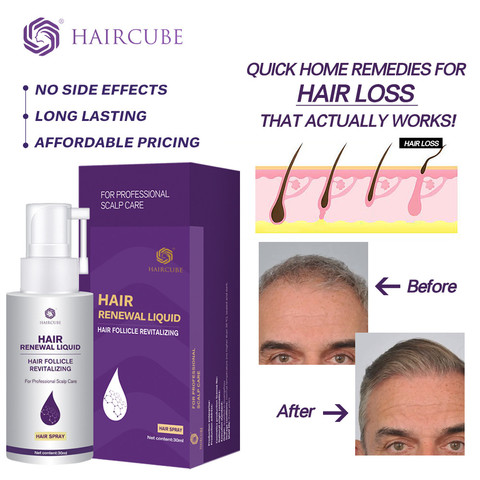 HAIRCUBE-Spray para el crecimiento del cabello, aceite para tratamiento de crecimiento rápido del cabello, suero anticaída, productos contra la caída del cabello ► Foto 1/6