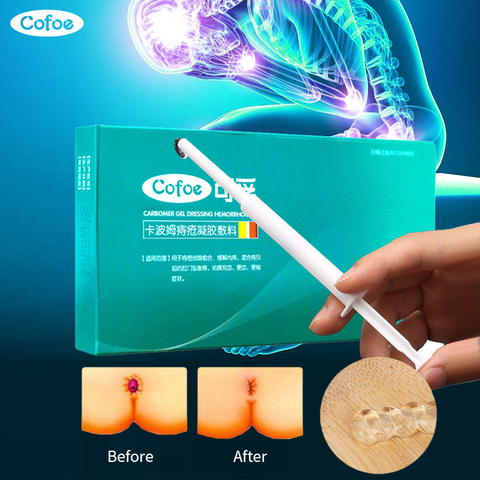 Cofoe Carbomer medicina hemorroide ungüento externo hemorroide Gel transparente con aplicador para el alivio de las hemorroides del ano ► Foto 1/6