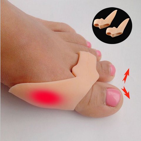 2 uds especial Hallux Valgus silicona gran hueso del dedo del pie Corrector plancha Gel pie dedos pedicura de dedos del pie separador de masaje para pies ► Foto 1/6