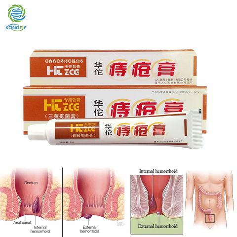 Hua Tuo-pomada Herbal china para hemorroides, crema para hemorroides, fibra Anal externa, tirita para cuidado de la salud, alivio del dolor ► Foto 1/6