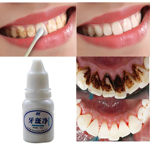 Gel Dental blanqueador, limpieza e higiene bucal de agua, limpieza Dental, blanqueamiento, 1 unidad, 10ml ► Foto 1/6