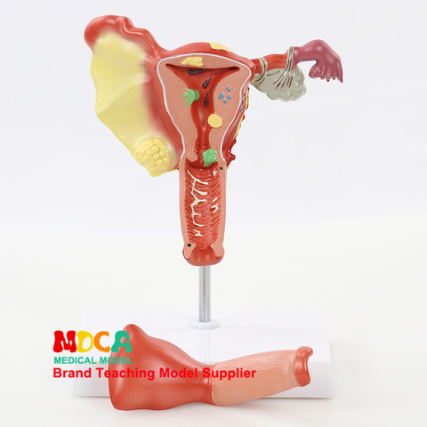 MSZXT004 enseñanza médica de la reproducción patológica y planificación familiar del modelo uterino y ovario humano y anatómico ► Foto 1/1