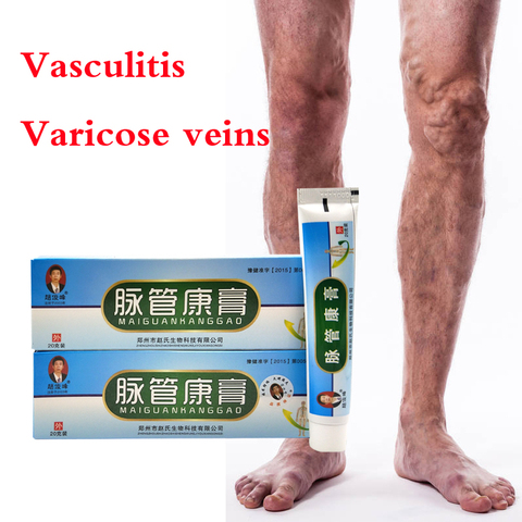 varicoza barbai pe picior venele varicoase ale simptomelor posedate din spate