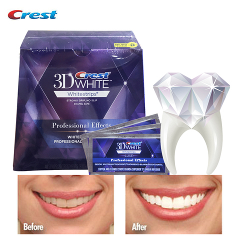 Tiras blanqueadoras para los dientes 3D para adultos, tiras blanqueadoras originales para higiene bucal, con efectos profesionales DE Luxe ► Foto 1/6