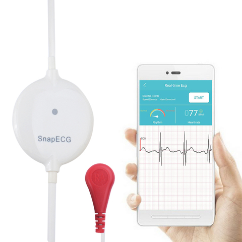 Mini Monitor ECG portátil para sistema Android, máquina de medición rápida, EKG, soporte cardíaco en tiempo Real, Holter de electrodos ► Foto 1/5