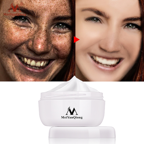 Fuerte efectos potente blanqueamiento Freckle crema 40g eliminar Melasma acné manchas pigmento melanina blanqueamiento hidratante cuidado de la piel ► Foto 1/6