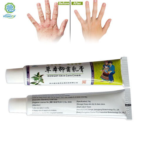 KONGDY 3 lotes chino naturaleza hierbas 15g de crema para el cuidado de la piel del cuerpo Dermatitis bálsamo para Psoriasis Eczema ungüento ► Foto 1/6