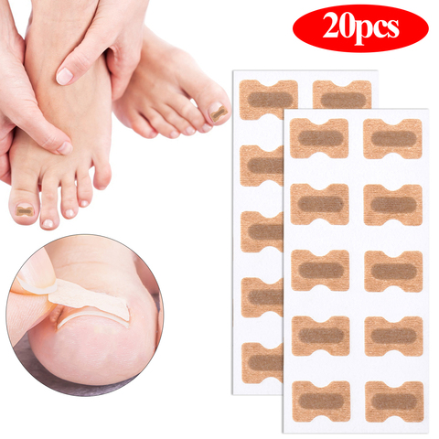 20/50/100 Uds corrección de uñas pegatinas encarnada Corrector para uñas de los pies parches paroniquia tratamiento recuperar Corrector para pedicura herramientas ► Foto 1/6