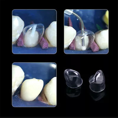 64 unids/pack 1.910/1.911/1.912/1.915 Dental transparente corona Anterior /Posterior/de hoja caduca Matrices matriz para adultos TOR BM ► Foto 1/6