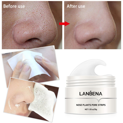 LANBENA eliminador de espinillas de la nariz máscara de banda para poros negro máscara de exfoliación de acné tratamiento mascarilla facial para limpieza profunda de Control de aceite de cuidado de la piel ► Foto 1/6