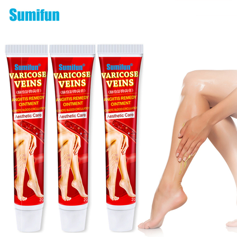 Sumifun varices tratamiento crema Vasculitis flebitis angitis inflamación vaso sanguíneo pierna podrida araña reparación ungüento ► Foto 1/6