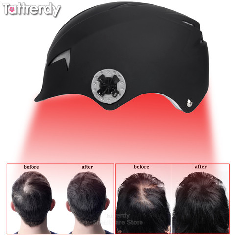 Gorro para el crecimiento del cabello para hombres y mujeres, gorra láser mejorada, solución para la pérdida de vello, tratamiento de diodos ► Foto 1/1