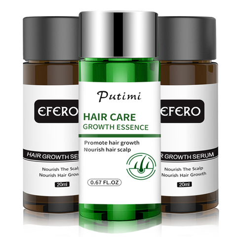 Uds producto de la pérdida del cabello de rápido crecimiento del cabello suero denso para el crecimiento del cabello pelo prevenir la calvicie pérdida suero de pelo aceites esenciales ► Foto 1/6