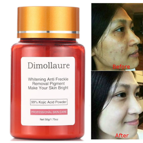 Dimollaure 50g 99% puro Ácido Kójico cuidado blanqueamiento crema antiarrugas El melasma acné puntos pigmento quemaduras de melanina ► Foto 1/6