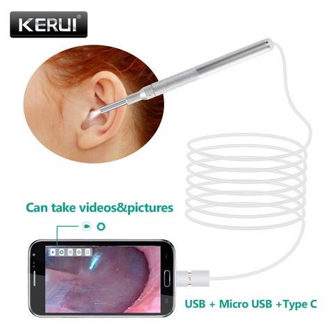 KERUI-lente más pequeña 480P otoscopio, endoscopio de inspección, boroscopio, cámara, limpiador de cera de los oídos, recolector de oídos para OTG Android PC ► Foto 1/6